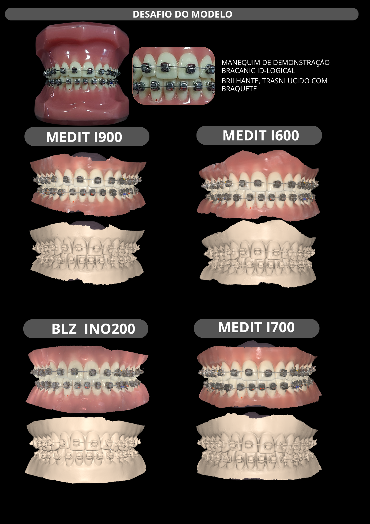 INO200 BLZDental