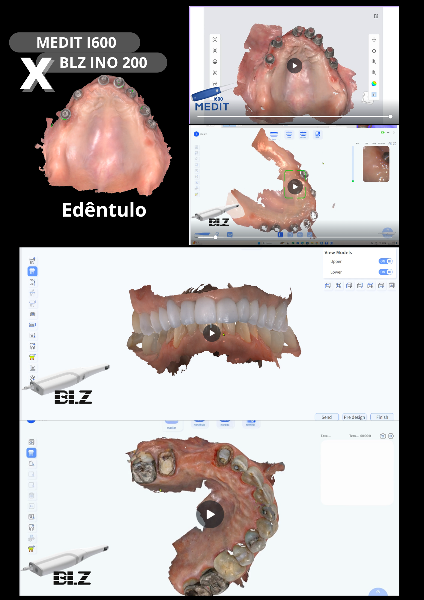 INO200 BLZDental c