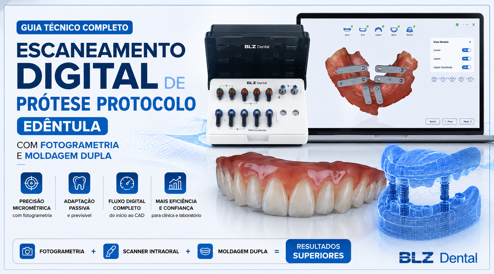 Escaneamento Protocolo: Fotogrametria e Moldagem Dupla